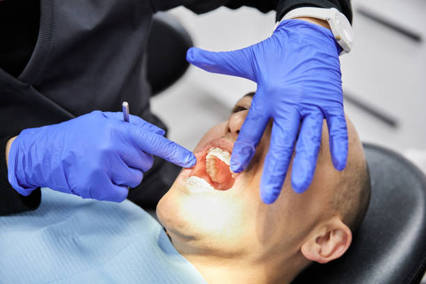 Best Emergency Root Canal Treatment in Verandah, FL