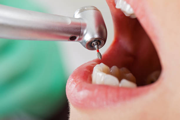 Best Weekend Emergency Dentist in Verandah, FL